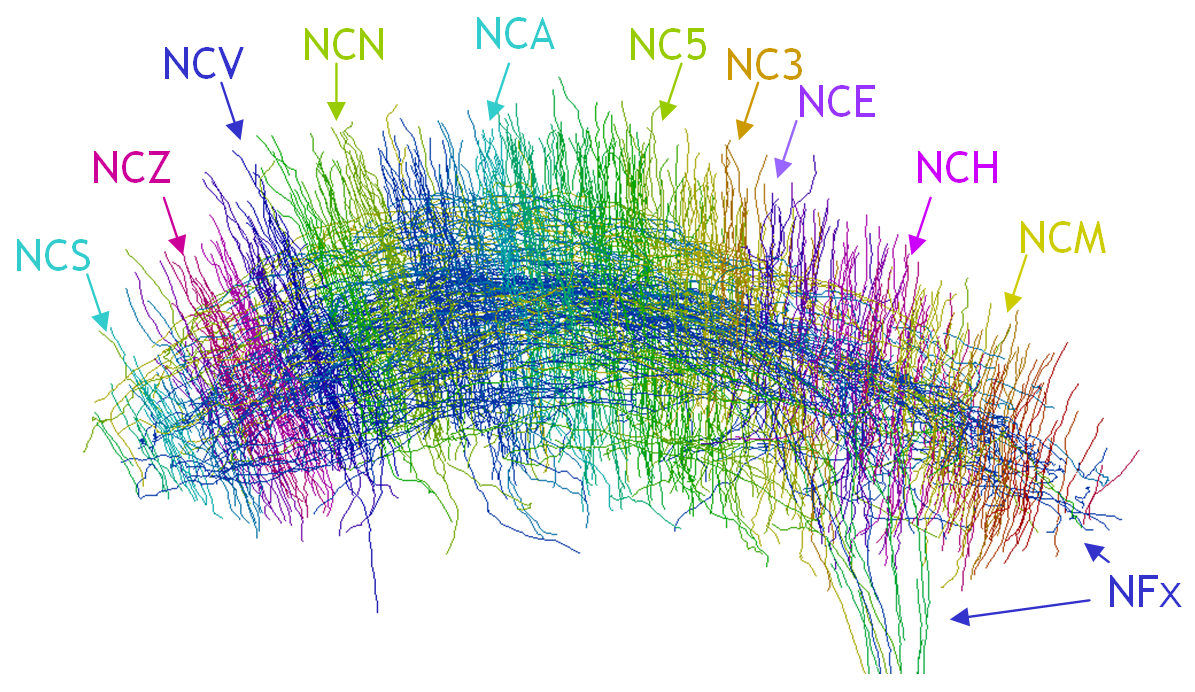 flyBrainFig1a_JStructBiol